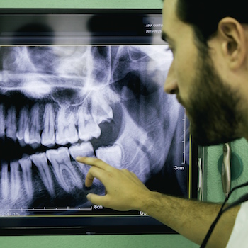 Médicos dentistas contestam modelo de integração no SNS